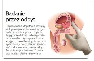 Badanie prostaty przez odbyt (badanie per rectum)