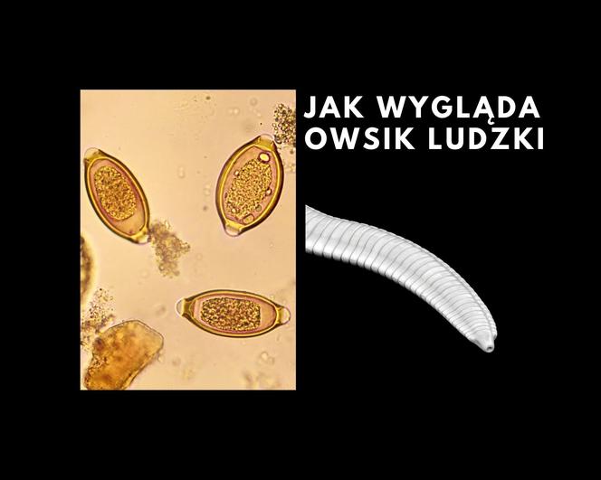 Jak wygląda owsik ludzki?