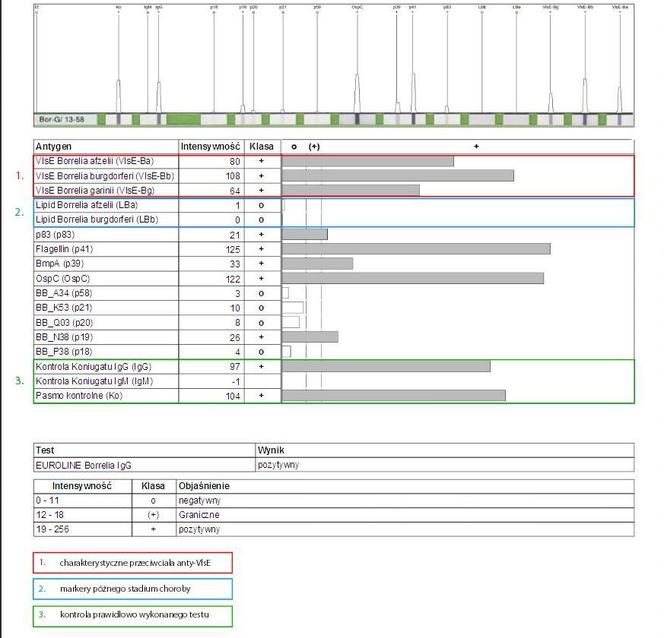 Prawidłowy test na boreliozę
